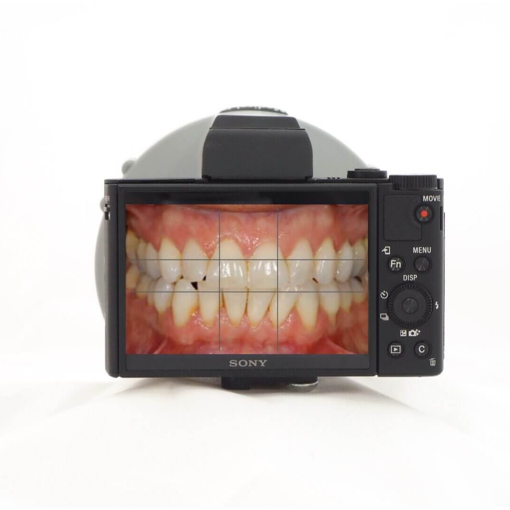 Sony Medical-D