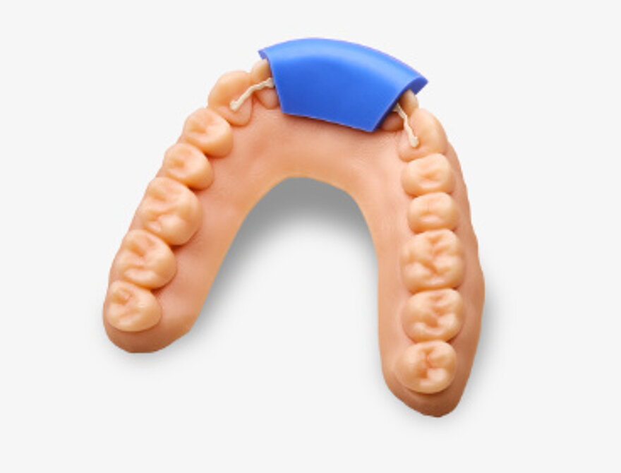 MEMOTAIN® lingual retainer