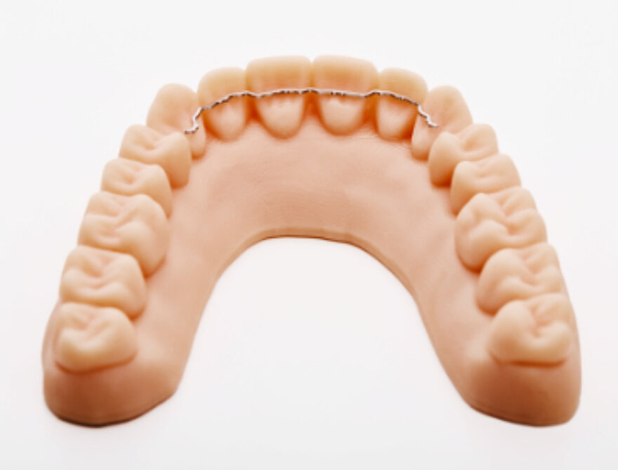 MEMOTAIN® lingual retainer