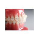 Agility Ceramic Roth .022 Refill