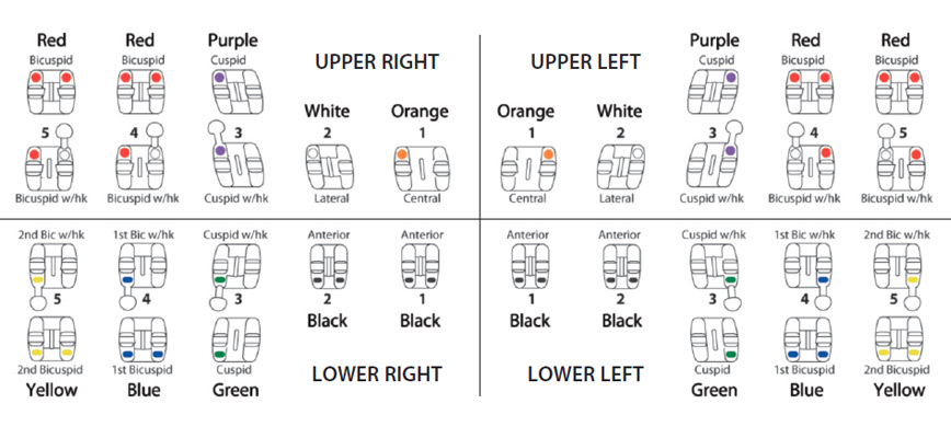 Kit miniPrevail MBT .022