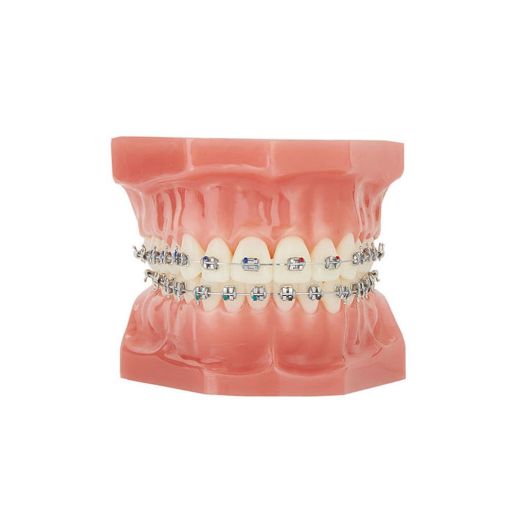Set Atlas Mini MBT .022