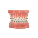 Set Atlas Mini MBT .022