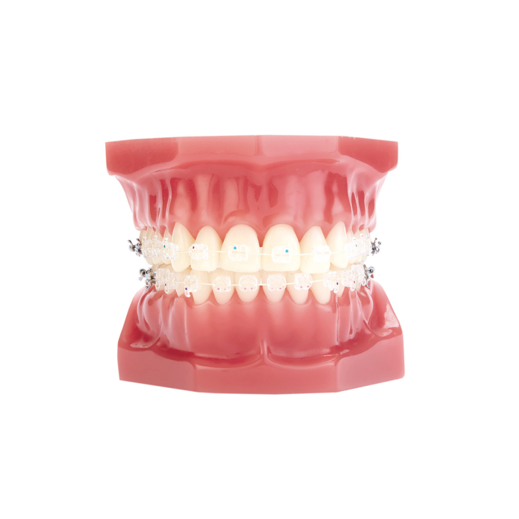 Bracket safir ClearViz+ Mini Roth .022 Refill