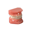 Set bracketi metalici Agility Twin .022