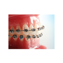 Bracket metalic miniPrevail Roth .022 Refill