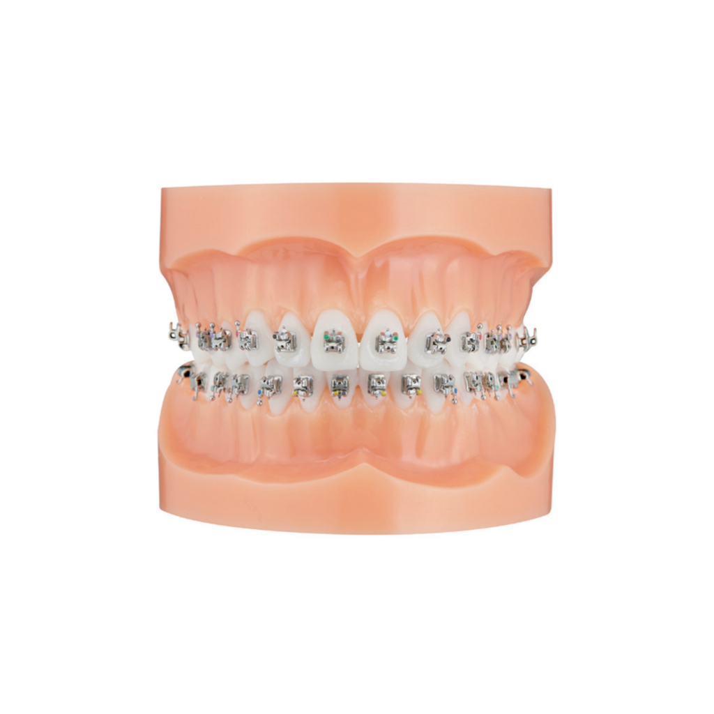 Bracket autoligaturant metalic Majesty Roth .022