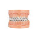 Bracket autoligaturant metalic Majesty Roth .022