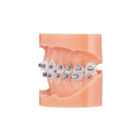 Bracket autoligaturant metalic Majesty Roth .022
