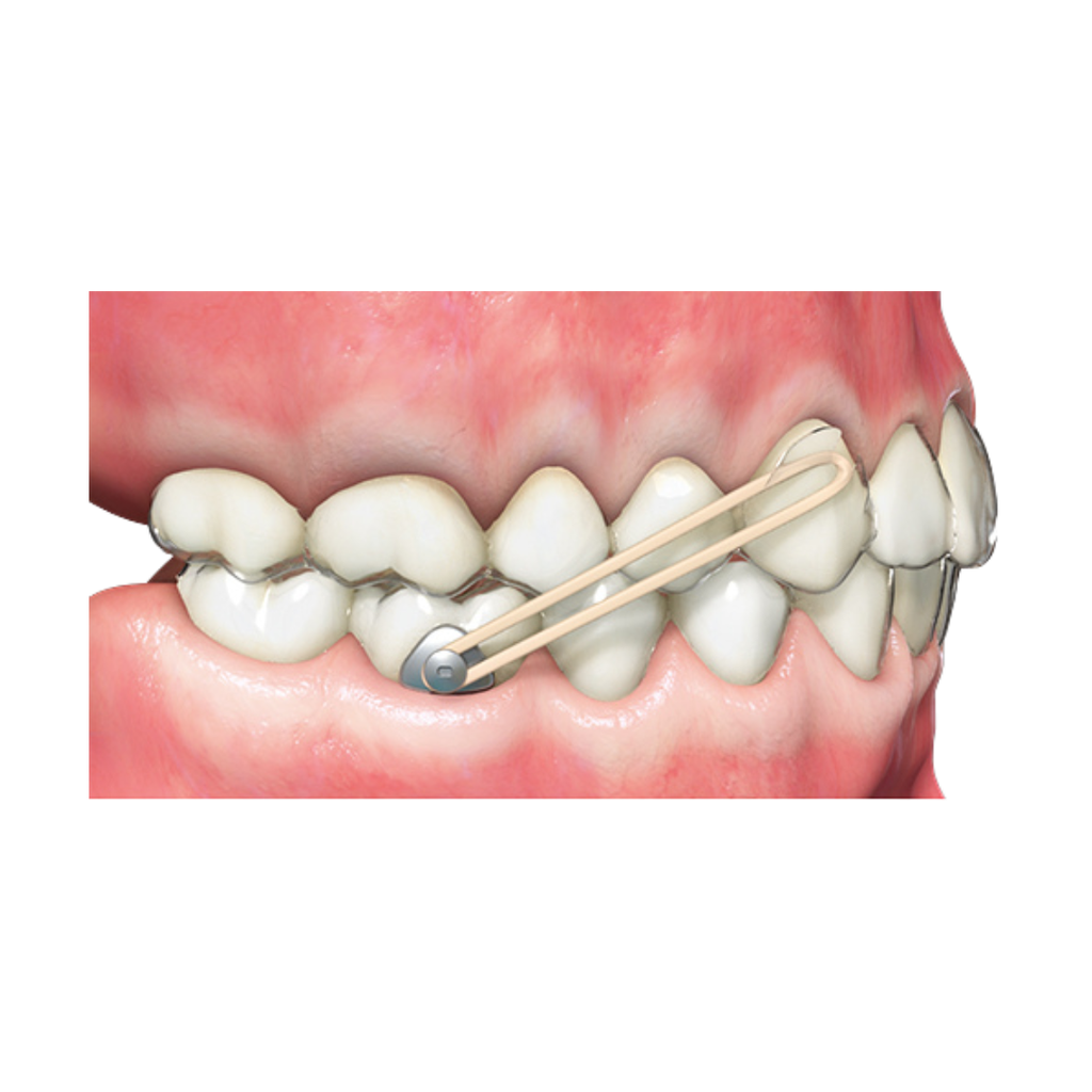 Buton colabil alignere metalic Precision mini