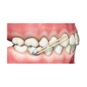 Buton colabil alignere metalic Precision mini