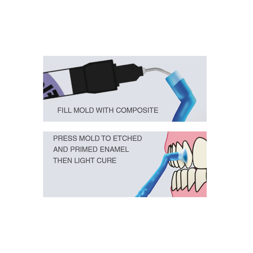 ReliaMold Starter Kit