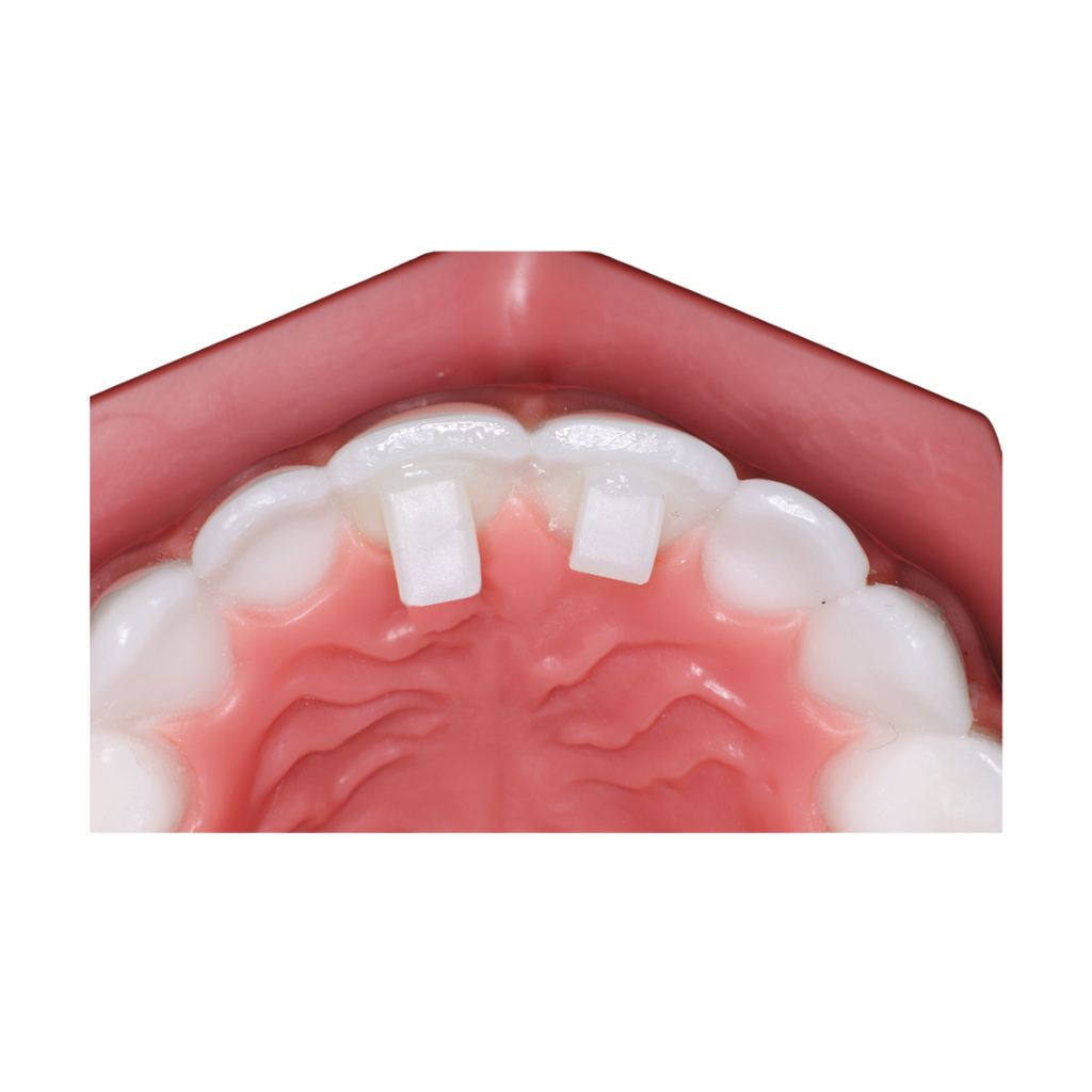 ReliaMold Starter Kit