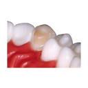 ReliaMold Starter Kit