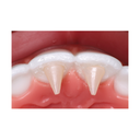 ReliaMold Starter Kit