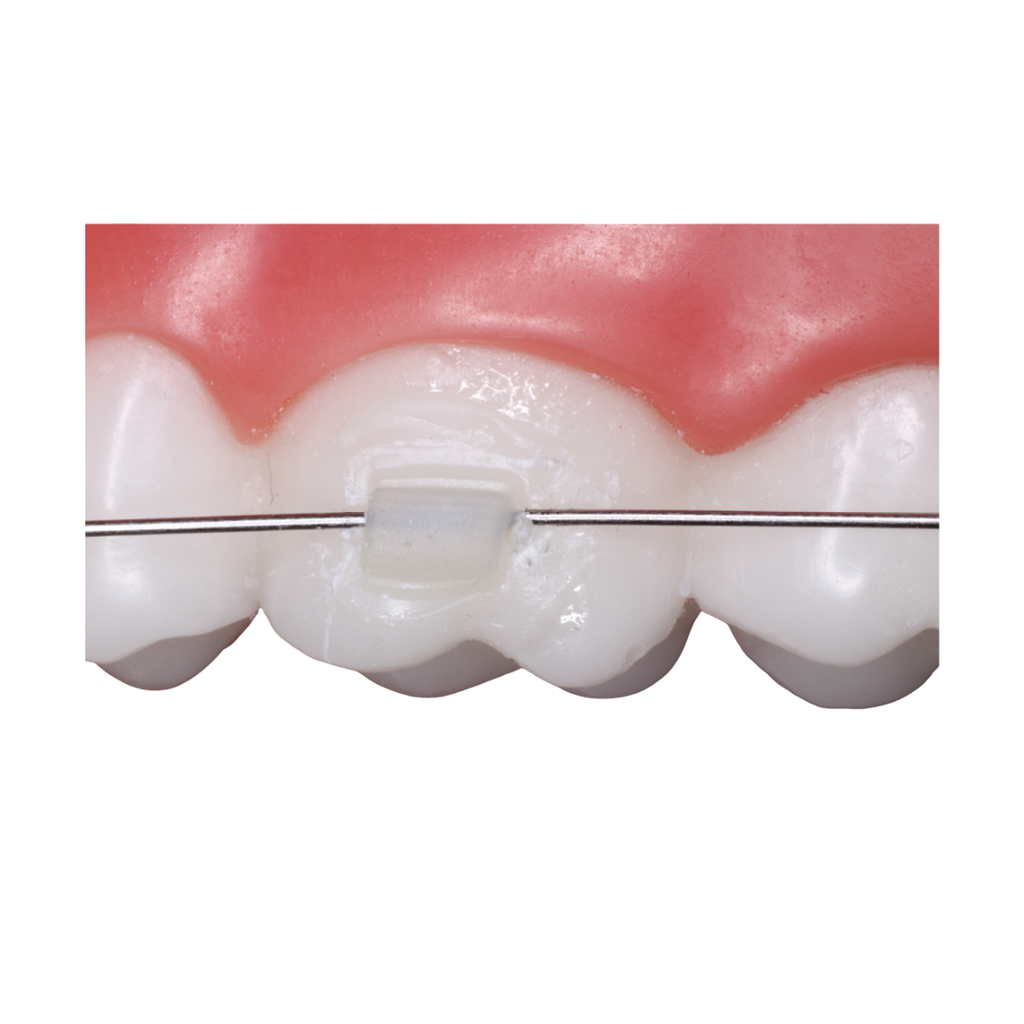 ReliaMold Starter Kit