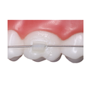 ReliaMold Starter Kit