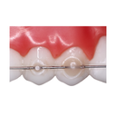 ReliaMold Starter Kit