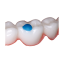 ReliaMold Starter Kit