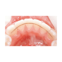 Retainer lingual Ortho FlexTech Otel