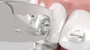 ┬®DynaFlex-Clear Debonding Plier Animation Still.webp