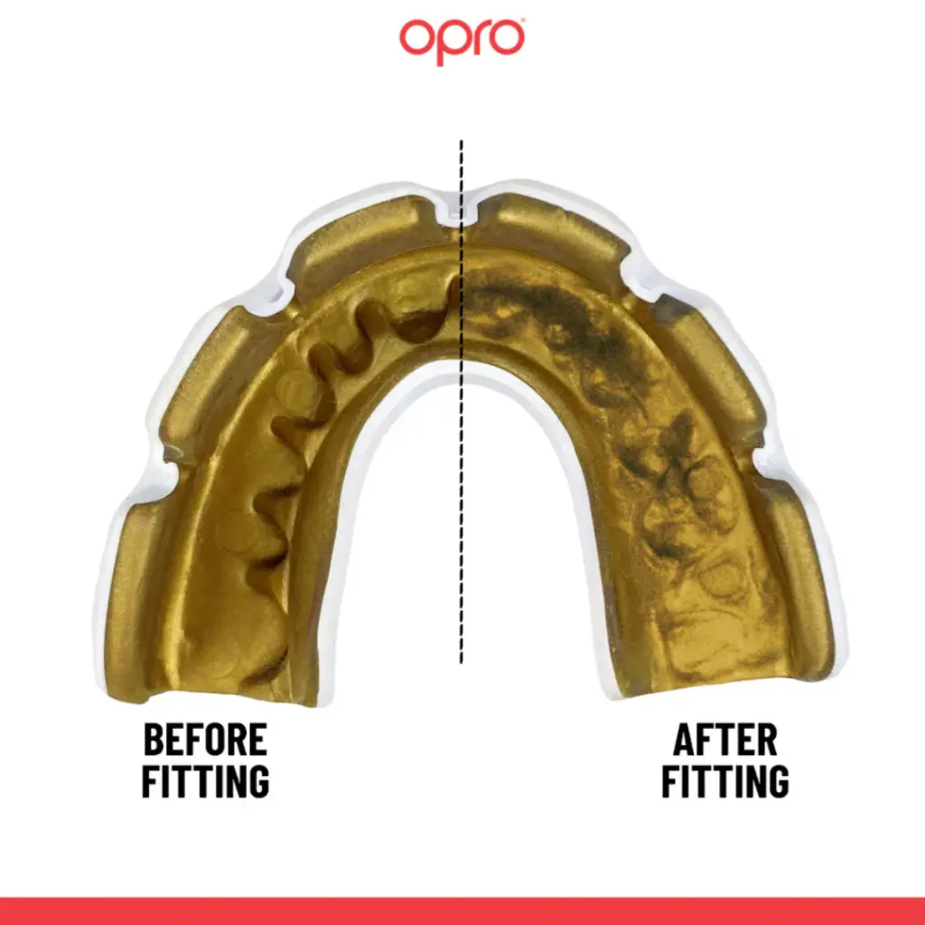 produse DB Orthodontics - 2026-07-13T140817.559.webp