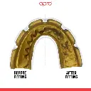 produse DB Orthodontics - 2026-07-13T140817.559.webp
