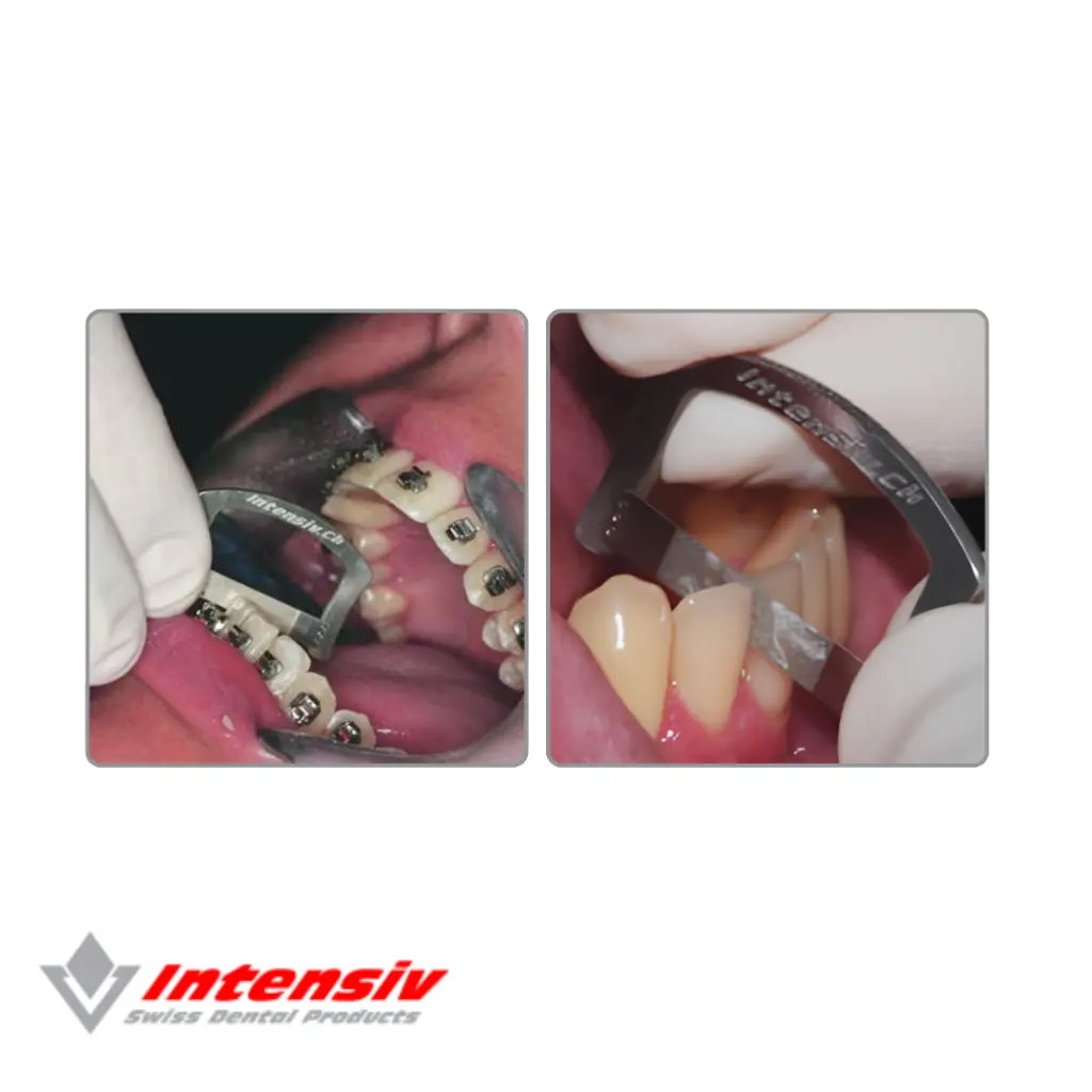 intensiv (3).webp